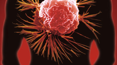 암세포가 스스로 죽게 유도하는 새로운 방식의 항암제 개발됐다