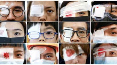 "눈 쏘지마라" 실명사건 항의하며 붕대감고 나온 홍콩시위대