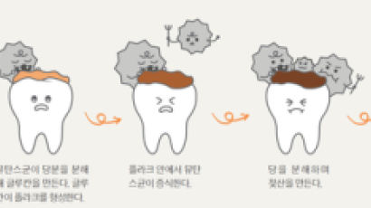 [라이프 트렌드] 아이 충치 예방? 6개월마다 검진, 자기 전 자일리톨 섭취!