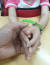 7살 어린이의 제작 사례. 왼 손(사진상 오른쪽)이 의수다. 장진영 기자
