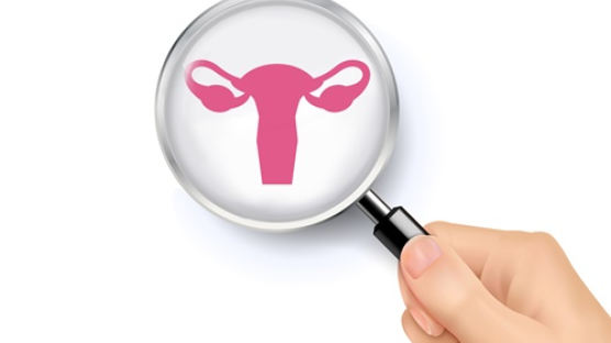 발생률 높아지는 자궁경부암, 부인과 검진으로 조기 치료·예방 가능