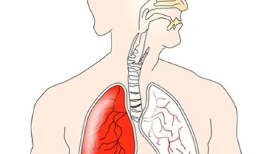 흡연·초미세먼지·분진…COPD고통 이젠 남의 일 아니다