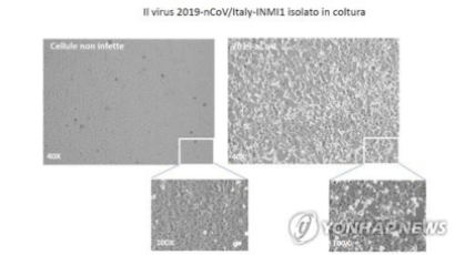이탈리아 “신종 코로나바이러스 분리 성공…백신·약 개발에 도움”