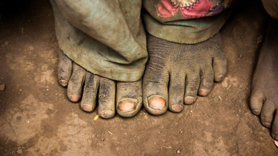 [더오래]가난을 두 발로 견딘다, 에티오피아 맨발의 아이들