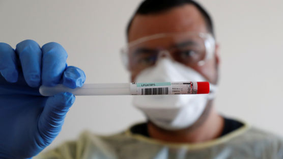 항체 있으면 '면역증' 준다? 유럽, 코로나 출구전략으로 항체검사 주목