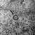 국내 신종코로나바이러스 감염증(코로나19) 확진자에게서 얻은 바이러스의 고해상 전자현미경 사진. 사진 질병관리본부