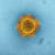  중동호흡기증후군(MERS, 메르스) 바이러스의 전자현미경 사진. 중앙포토