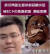 코로나19에 감염된 이후 얼굴이 새까맣게 변한 중국 우한시중심병원 비뇨기과 부주임인 후웨이펑(胡偉鋒)이 2일 오전 사망했다. 북경위성방송 캡처