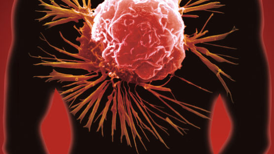 암세포만 끝까지 추적해 잡아 먹는 항암 면역치료법 나왔다 