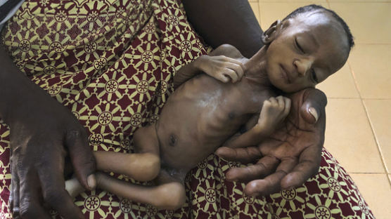 생후 1개월에 1.2㎏…코로나에 매달 1만명씩 굶어 죽는다