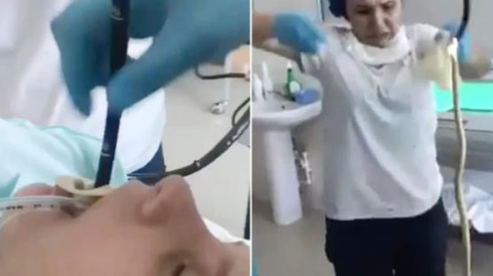 러시아 여성 몸서 나온 1.2m 뱀…의사도 놀라 뒷걸음질쳤다