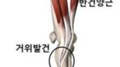 [더오래]무릎 안쪽 눌렀을 때 아프면 관절염 가능성 