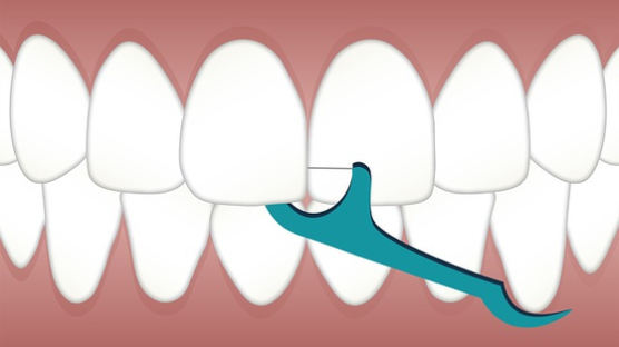 [더오래]6개월마다 정기 진료? 스케일링의 오해와 진실 