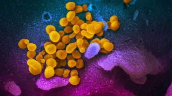 독감은 코로나 더 독하게 만든다···“증세 더 악화” 첫 실험 증거