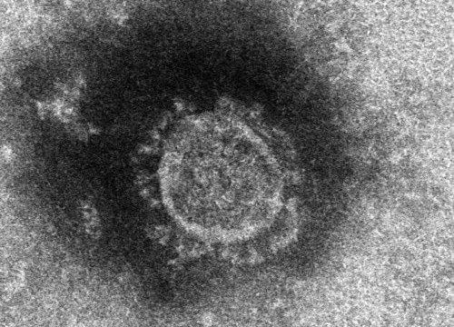 전자현미경으로 본 코로나19. 바이러스 유전물질인 RNA를 외피가 싸고 있고, 외피에는 못처럼 생긴 스파이크 단백질이 삐죽삐죽 나와있다. 사진 일본 국립 감염증 연구소