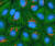 불멸의 암세포 '헬라세포' 현미경 관찰 모습. [사진 NIH=위키미디어]