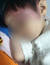 지난 5일 친모의 남자친구의 폭행으로 4살 아이의 얼굴에 피멍이 들었다. 사진 피해 아동 친부=연합뉴스
