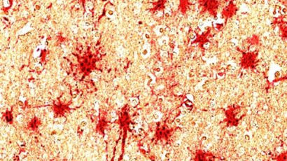 치매 원인 '뇌염증' 차단···국내 연구진 'C8-감마' 단백질 찾았다