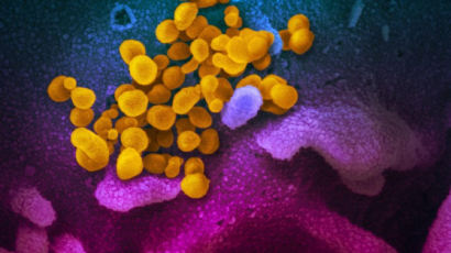 독일 "바이러스 증식 성분 발견"…코로나 새 치료제 나오나