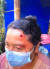 15일(현지시간) 미얀마 만달레이에서 군·경이 발사한 고무탄에 맞고 부상 당한 현지인. [프론티어 미얀마 트위터]