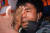 20일 만달레이 시위에서 한 시위자가 부상을 입고 눈에서 피를 흘리고 있다. [AFP=연합뉴스]