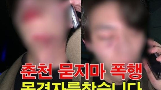 춘천 '묻지마 폭행' 발생…"머리채 잡고 때려, 목격자 찾는다"