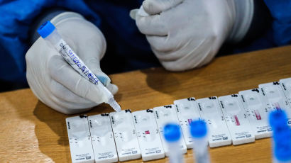 러 백신 맞고 확진된 아르헨 대통령…푸틴에 "증상 거의 없다"