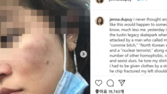 "北 매춘부 욕하며 3시간 폭행"…10대 한국계女 증오범죄 흑인 체포 