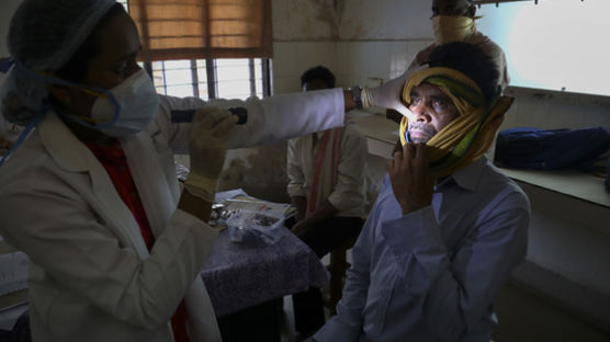 인도 7000명 '안구적출' 공포 떤다···검은곰팡이 부른 이 약물