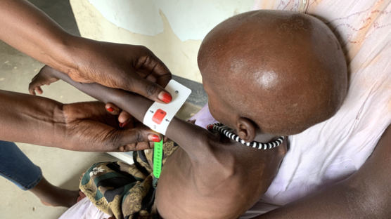 월드비전 “소말리아 대기근 10년이 지났지만 여전히 4100만명 기아 위기”