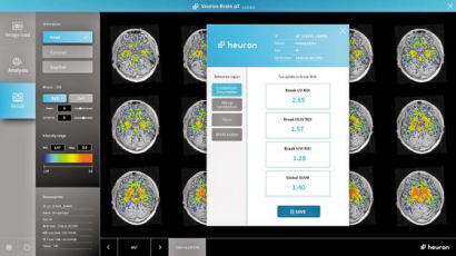 [issue&] 세계 첫 MRI 기반 파킨슨병 A.I 진단 솔루션 개발해 유럽 CE인증받아
