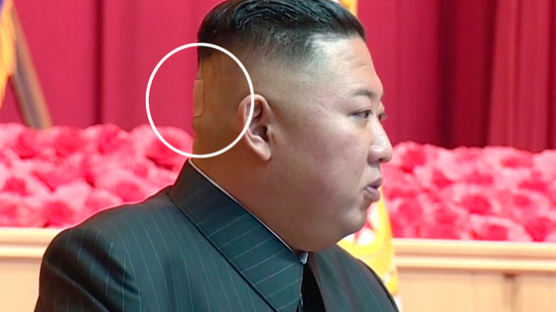 김정은 공식석상 '뒤통수 파스'···뗀 자리엔 의문의 검은상처
