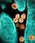 코로나19 바이러스의 현미경 관찰모습. 세포 끝 왕관처럼 생긴 뾰족한 점들은 '스파이크'로, 바이러스가 몸속에 침투해 세포와 결합할 때 역할을 한다. AFP=연합뉴스