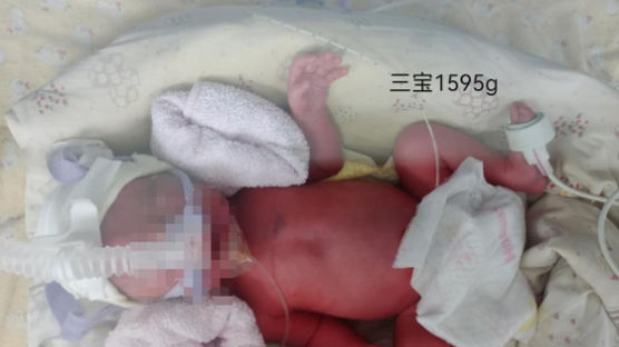 델타 감염된 中 임산부 세쌍둥이 출산…신생아 모두 '음성'