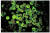 뇌 먹는 아메바인 ‘파울러자유아메바’(Naegleria fowleri)의 현미경 사진. 사진 위키피디아