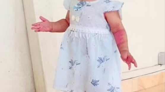 미국 반격 때 숨진 아프간 2살 아기 2명… "새카맣게 타 얼굴도 못 알아봐" 