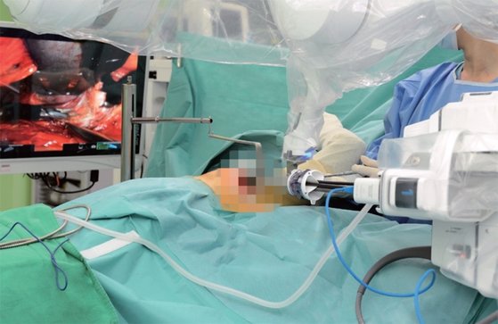 연세암병원 의료진이 로봇수술기 다빈치를 이용해 수술하고 있다. 연세암병원은 2005년 국내 최초로 로봇수술을 도입했다. / 사진:연세암병원