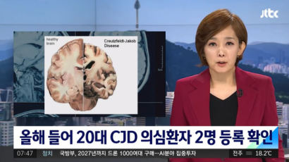 20대 여성 2명, ‘인간 광우병’ 변종 CJD 의심환자 등록…방역당국 조사 