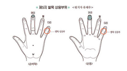 [건강한 가족] 발목 삐면 가장 아픈 지점 자극 '서금요법' 효과 