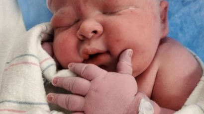"이런 신생아 처음" 베테랑 의료진도 놀란 6.3㎏ 수퍼베이비