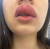 브라질 여성 나탈리 갈디노가 지네에 입술이 물렸다며 공개한 모습. 그는 지네에 물린 입술이 퉁퉁 부어오르고, 통증과 호흡곤란 증상까지 나타나 병원을 찾았다.[트위터 캡처]