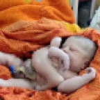 팔·다리 4개인 아기 탄생…"신의 현신" 인도가 발칵 뒤집혔다