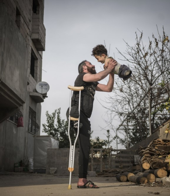 다리 잃은 父, 사지 없는 아이 '번쩍'…시리아 그 가족 伊 정착 