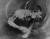 1960년 4월 11일 최루탄이 눈에 박힌 채 발견된 고 김주열 열사. [중앙포토]