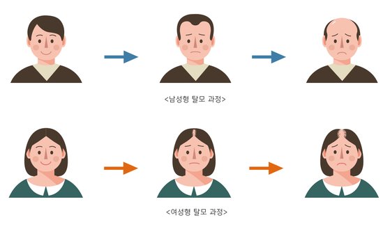 여성탈모의 가장 주된 원인 갱년기탈모