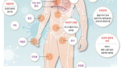 수면장애·탈모·이명·호흡곤란…코로나 후유증 증상만 200개