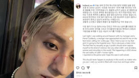 가수 홀랜드 "게이 이유로 폭행…'더러운 XX'라며 얼굴 가격"