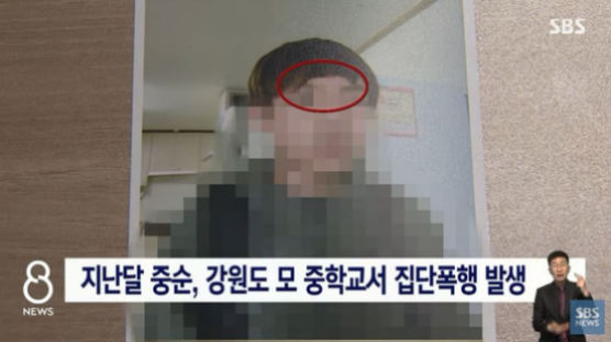 온몸 멍들고 코 휘었는데…"어머님, 애들 장난이에요" 황당 교사