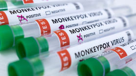 英 보건안전청 "감염위험집단에 원숭이두창 백신접종 권고"