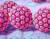 HPV 바이러스. 다양한 유형으로 존재하며 이 중 일부는 피부에 종양을 일으키고 심지어 암을 발생시킨다. 자궁경부암뿐 아니라 다양한 두경부암을 발생시키는 것으로 드러났다. 사진 UCSF